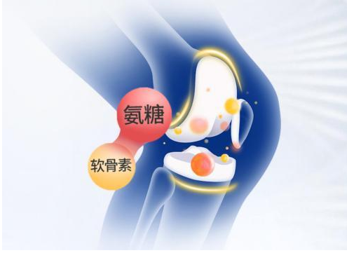 怎样选购氨糖？这几点真的很重要！