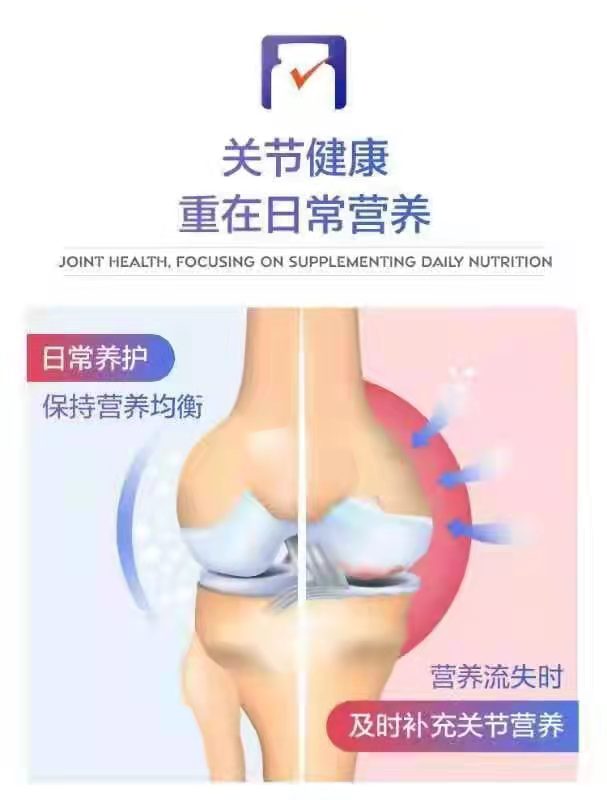 氨糖软骨素钙片价格是多少？大家都能接受的！