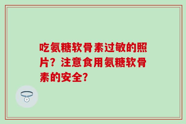吃氨糖软骨素过敏的照片？注意食用氨糖软骨素的安全？