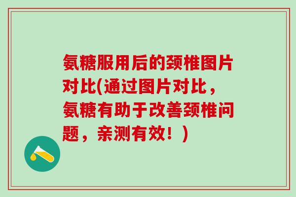 氨糖服用后的颈椎图片对比(通过图片对比，氨糖有助于改善颈椎问题，亲测有效！)