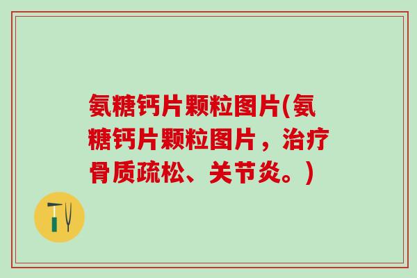 氨糖钙片颗粒图片(氨糖钙片颗粒图片，治疗骨质疏松、关节炎。)