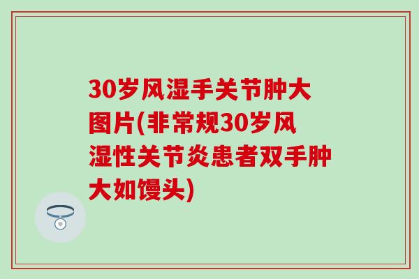 30岁手关节肿大图片(非常规30岁性患者双手肿大如馒头) 30岁手关节肿大图片(非常规30岁性患者双手肿大如馒头)