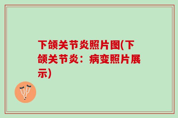 下颌关节炎照片图(下颌关节炎：病变照片展示)