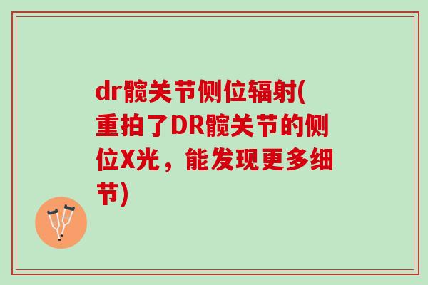 dr髋关节侧位辐射(重拍了DR髋关节的侧位X光，能发现更多细节)
