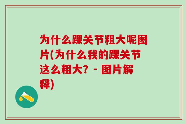 为什么踝关节粗大呢图片(为什么我的踝关节这么粗大？- 图片解释)