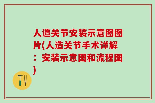 人造关节安装示意图图片(人造关节手术详解：安装示意图和流程图)