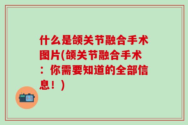 什么是颌关节融合手术图片(颌关节融合手术：你需要知道的全部信息！)