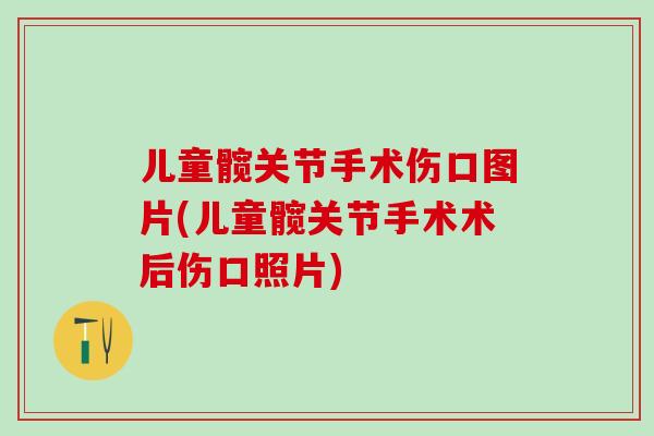 儿童髋关节手术伤口图片(儿童髋关节手术术后伤口照片)