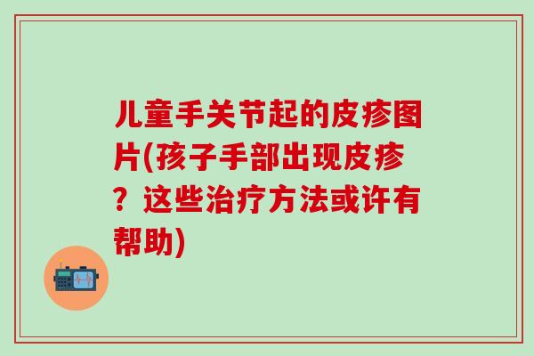儿童手关节起的皮疹图片(孩子手部出现皮疹？这些方法或许有帮助)