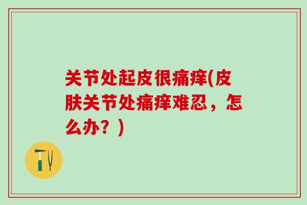关节处起皮很痛痒(关节处痛痒难忍,怎么办?) 关节处起皮很痛痒(关节处痛痒难忍,怎么办?)