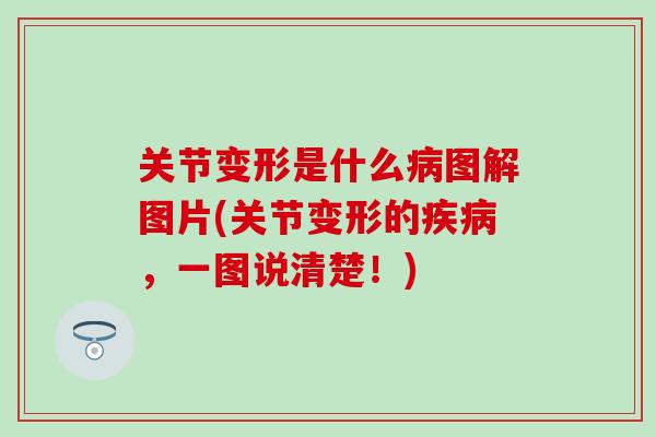 关节变形是什么病图解图片(关节变形的疾病，一图说清楚！)
