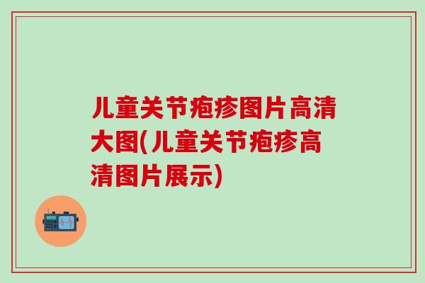 儿童关节疱疹图片高清大图(儿童关节疱疹高清图片展示)