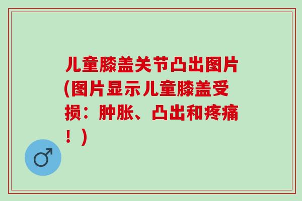 儿童膝盖关节凸出图片(图片显示儿童膝盖受损：肿胀、凸出和疼痛！)