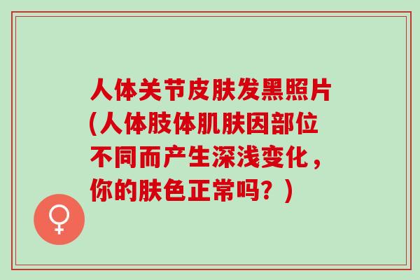 人体关节皮肤发黑照片(人体肢体肌肤因部位不同而产生深浅变化，你的肤色正常吗？)