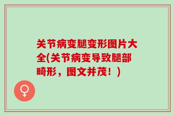 关节病变腿变形图片大全(关节病变导致腿部畸形，图文并茂！)