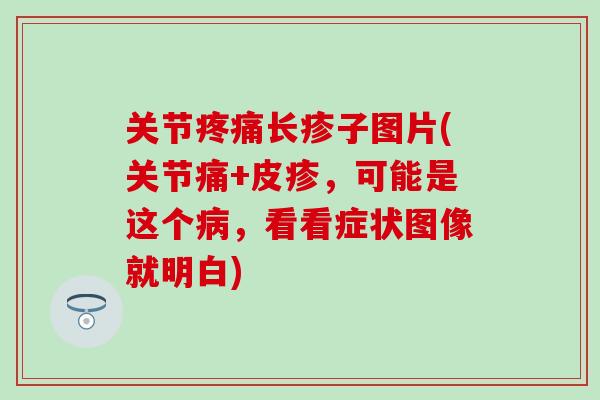 关节疼痛长疹子图片(关节痛+皮疹，可能是这个病，看看症状图像就明白)