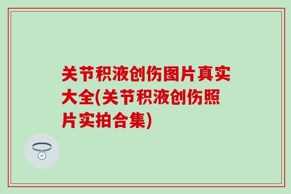 关节积液创伤图片真实大全(关节积液创伤照片实拍合集)