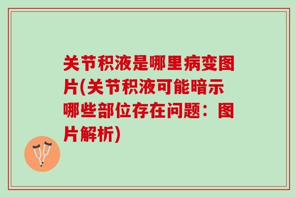 关节积液是哪里病变图片(关节积液可能暗示哪些部位存在问题：图片解析)