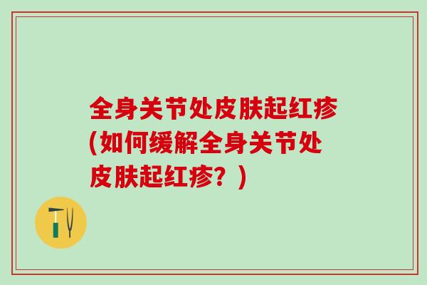 全身关节处皮肤起红疹(如何缓解全身关节处皮肤起红疹？)