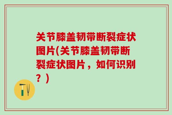 关节膝盖韧带断裂症状图片(关节膝盖韧带断裂症状图片，如何识别？)