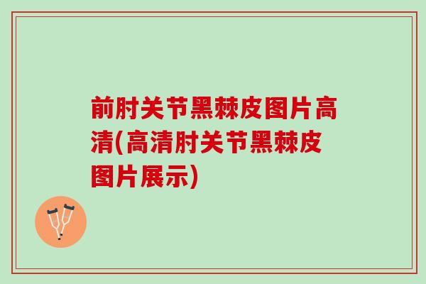 前肘关节黑棘皮图片高清(高清肘关节黑棘皮图片展示)