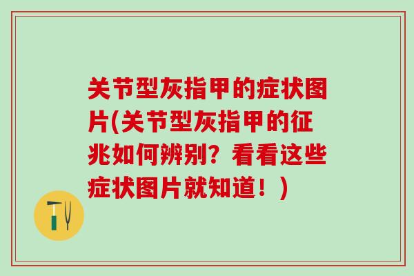 关节型灰指甲的症状图片(关节型灰指甲的征兆如何辨别？看看这些症状图片就知道！)