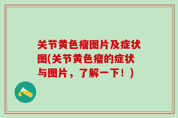 关节黄色瘤图片及症状图(关节黄色瘤的症状与图片，了解一下！)