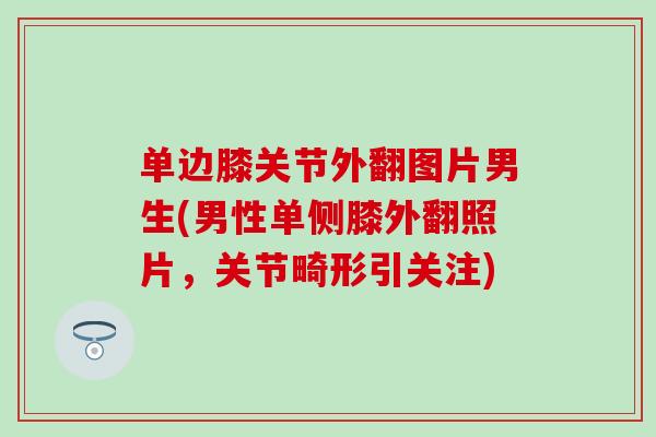 单边膝关节外翻图片男生(男性单侧膝外翻照片,关节畸形引关注) 单边膝关节外翻图片男生(男性单侧膝外翻照片,关节畸形引关注)