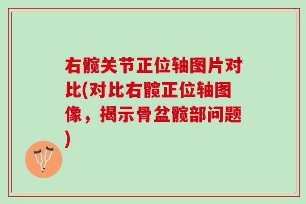 右髋关节正位轴图片对比(对比右髋正位轴图像，揭示骨盆髋部问题)