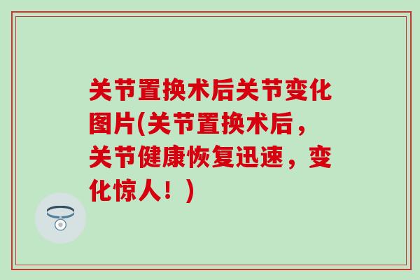 关节置换术后关节变化图片(关节置换术后，关节健康恢复迅速，变化惊人！)