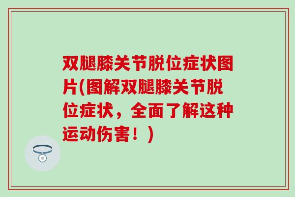 双腿膝关节脱位症状图片(图解双腿膝关节脱位症状，全面了解这种运动伤害！)