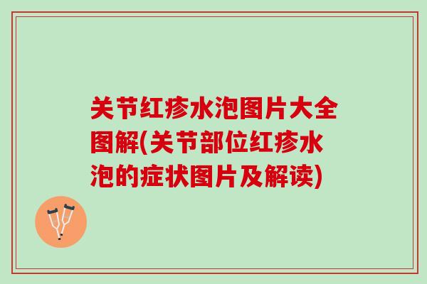 关节红疹水泡图片大全图解(关节部位红疹水泡的症状图片及解读) 关节红疹水泡图片大全图解(关节部位红疹水泡的症状图片及解读)