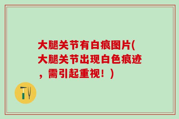 大腿关节有白痕图片(大腿关节出现白色痕迹，需引起重视！)