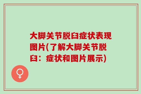 大脚关节脱臼症状表现图片(了解大脚关节脱臼：症状和图片展示)