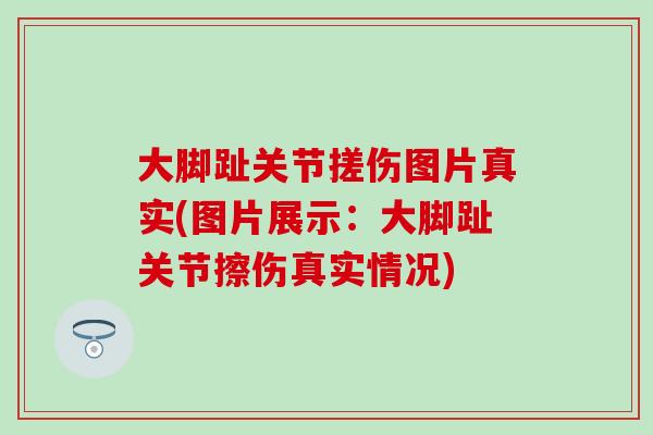 大脚趾关节搓伤图片真实(图片展示:大脚趾关节擦伤真实情况) 大脚趾关节搓伤图片真实(图片展示:大脚趾关节擦伤真实情况)