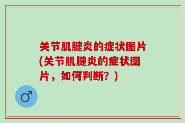 关节的症状图片(关节的症状图片,如何判断?) 关节的症状图片(关节的症状图片,如何判断?)