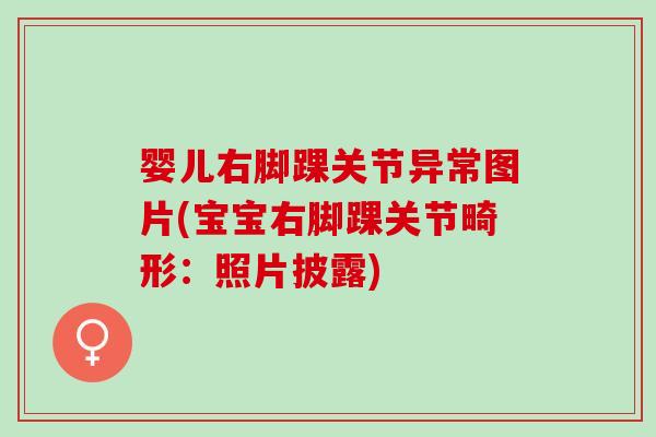 婴儿右脚踝关节异常图片(宝宝右脚踝关节畸形：照片披露)