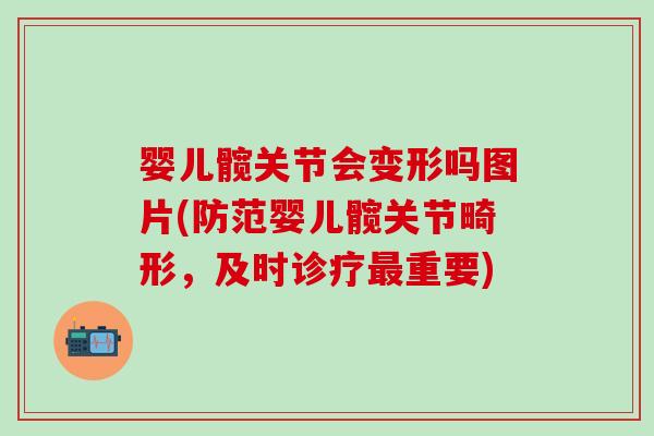 婴儿髋关节会变形吗图片(防范婴儿髋关节畸形，及时诊疗最重要)