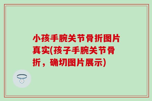 小孩手腕关节图片真实(孩子手腕关节,确切图片展示) 小孩手腕关节图片真实(孩子手腕关节,确切图片展示)