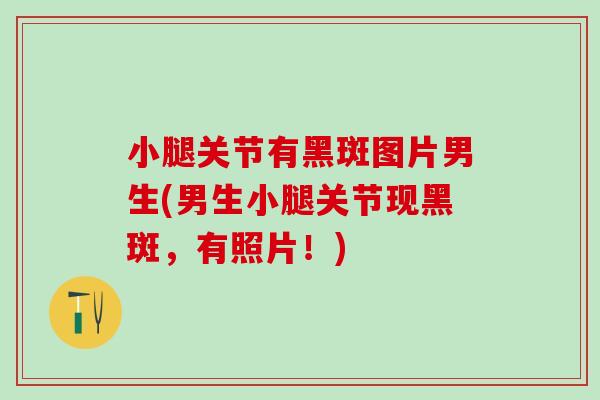 小腿关节有黑斑图片男生(男生小腿关节现黑斑，有照片！)