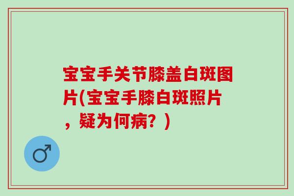 宝宝手关节膝盖白斑图片(宝宝手膝白斑照片，疑为何病？)
