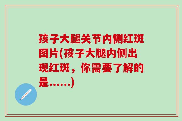 孩子大腿关节内侧红斑图片(孩子大腿内侧出现红斑,你需要了解的是......) 孩子大腿关节内侧红斑图片(孩子大腿内侧出现红斑,你需要了解的是......)