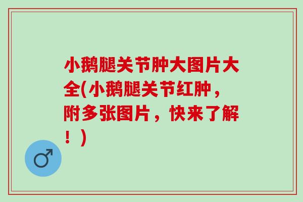 小鹅腿关节肿大图片大全(小鹅腿关节红肿，附多张图片，快来了解！)