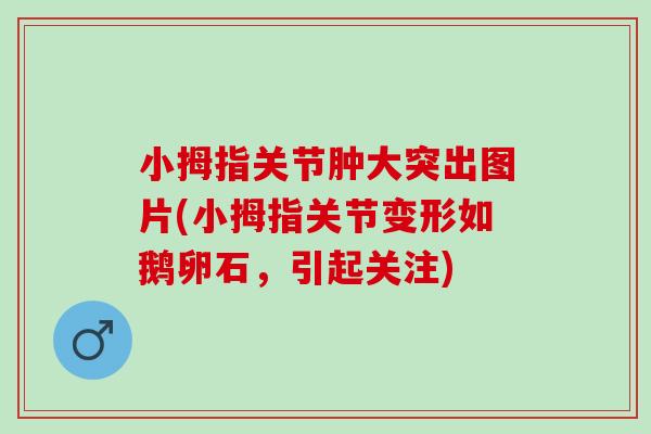 小拇指关节肿大突出图片(小拇指关节变形如鹅卵石，引起关注)