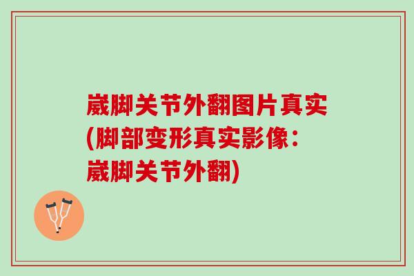 崴脚关节外翻图片真实(脚部变形真实影像：崴脚关节外翻)