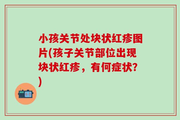 小孩关节处块状红疹图片(孩子关节部位出现块状红疹，有何症状？)