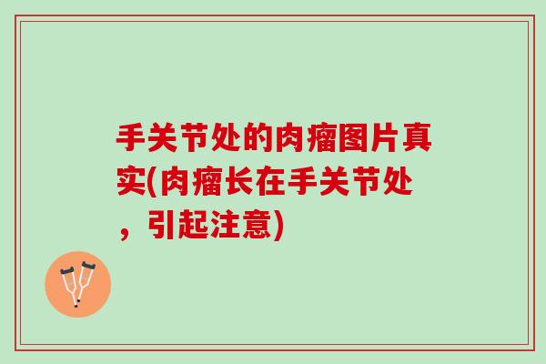 手关节处的肉瘤图片真实(肉瘤长在手关节处，引起注意)