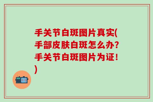 手关节白斑图片真实(手部皮肤白斑怎么办？手关节白斑图片为证！)