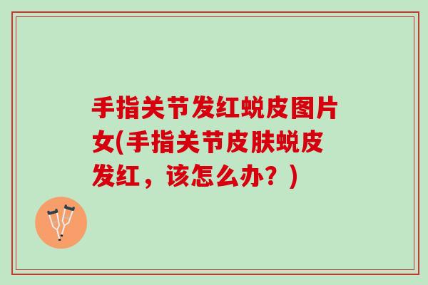 手指关节发红蜕皮图片女(手指关节皮肤蜕皮发红，该怎么办？)