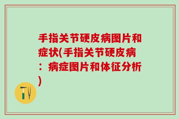 手指关节硬皮病图片和症状(手指关节硬皮病：病症图片和体征分析)